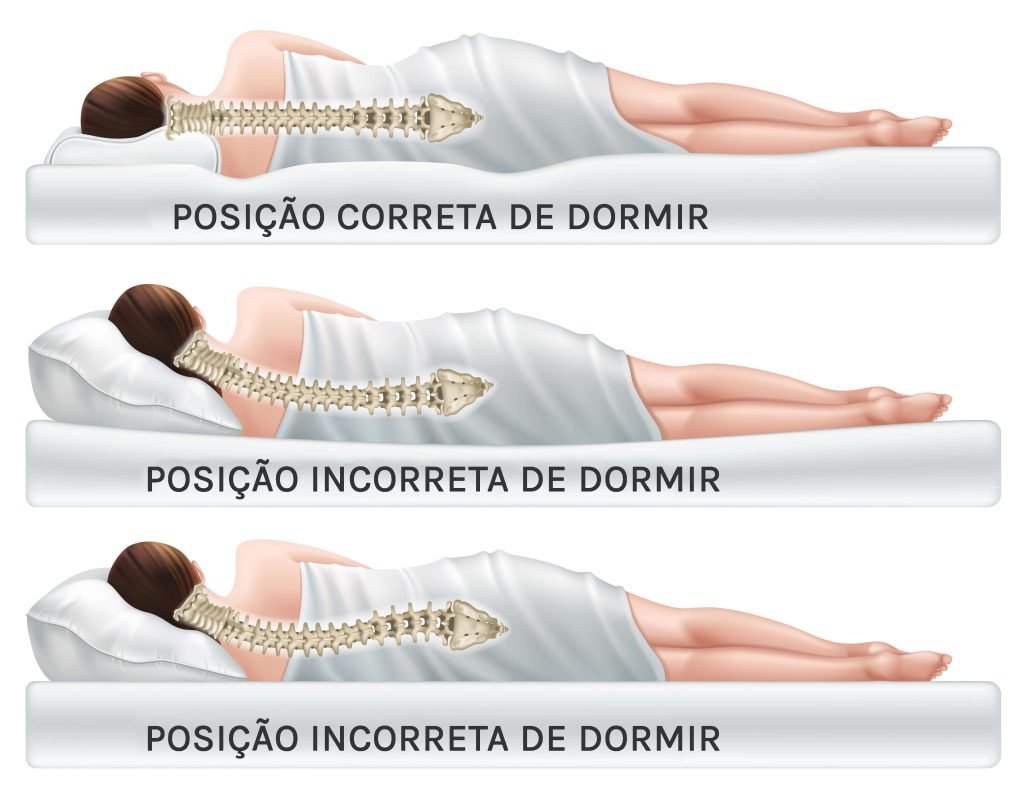 Postura corporal ao dormir para evitar dores na coluna