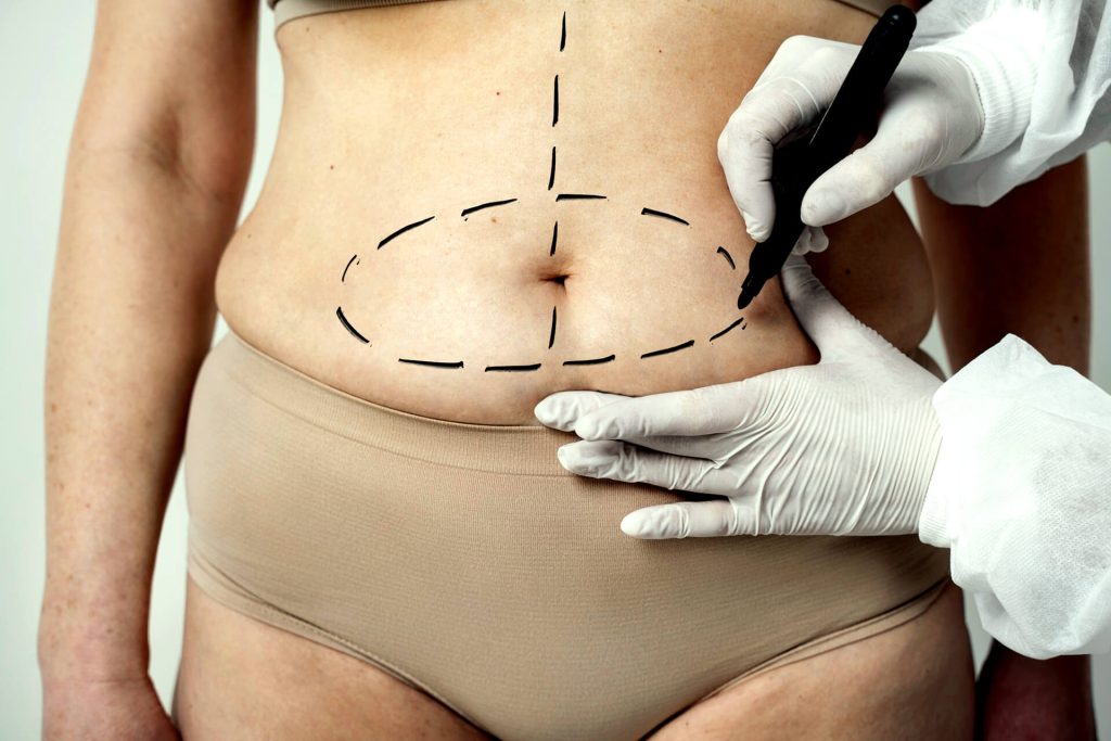 Massagem Pós-Operatória para eliminação do inchaço e toxinas