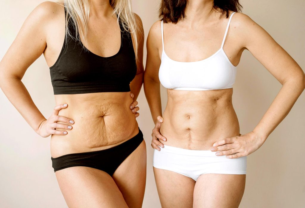 Cada procedimento cirúrgico é único e deve ser levado em consideração na realização da Massagem Pós-Operatória