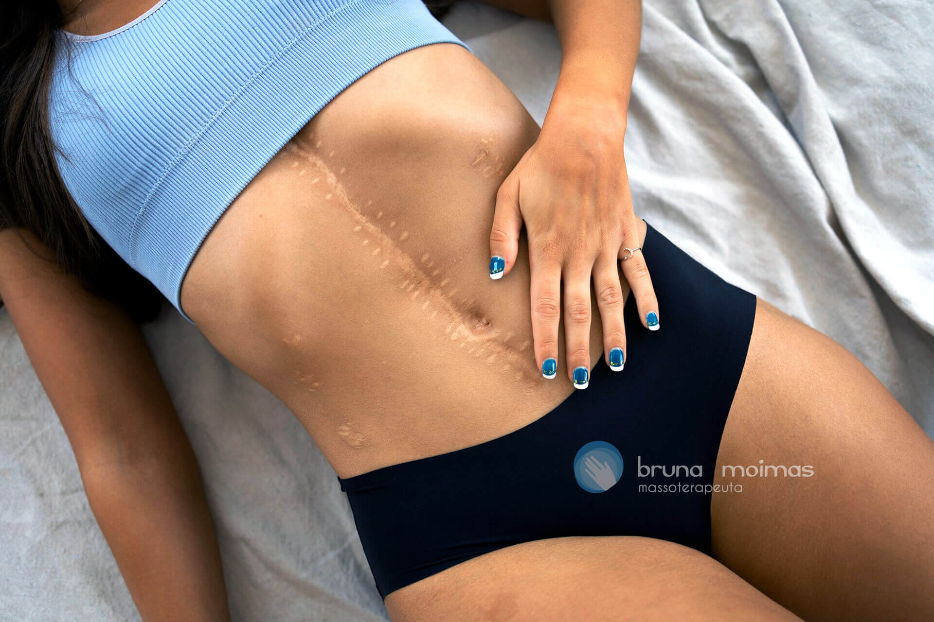 6 benefícios da Massagem Pós-Cirúrgica para acelerar o restabelecimento